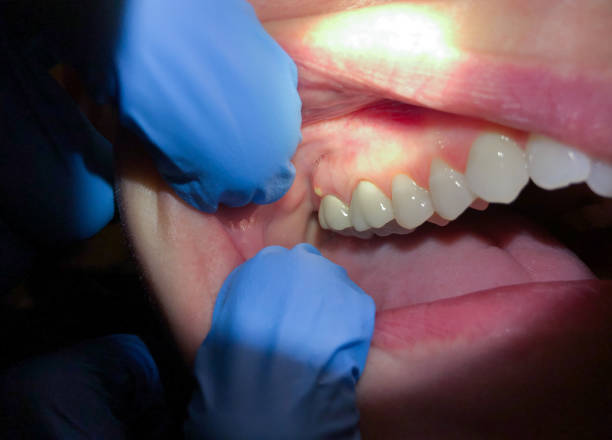 Best Emergency Dentist for Special Needs Patients in Mccaysville, GA