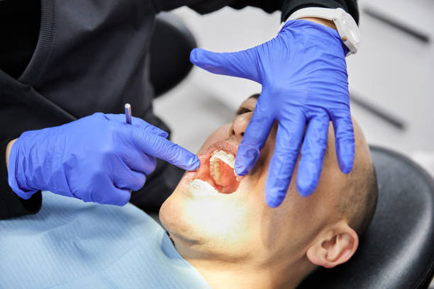 Best Emergency Dentist for Lost Fillings or Crowns in Mccaysville, GA