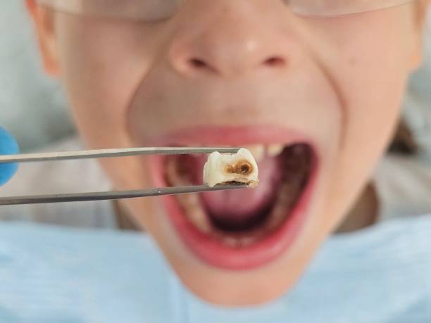 Best Orthodontic Emergency Dentist in Mccaysville, GA